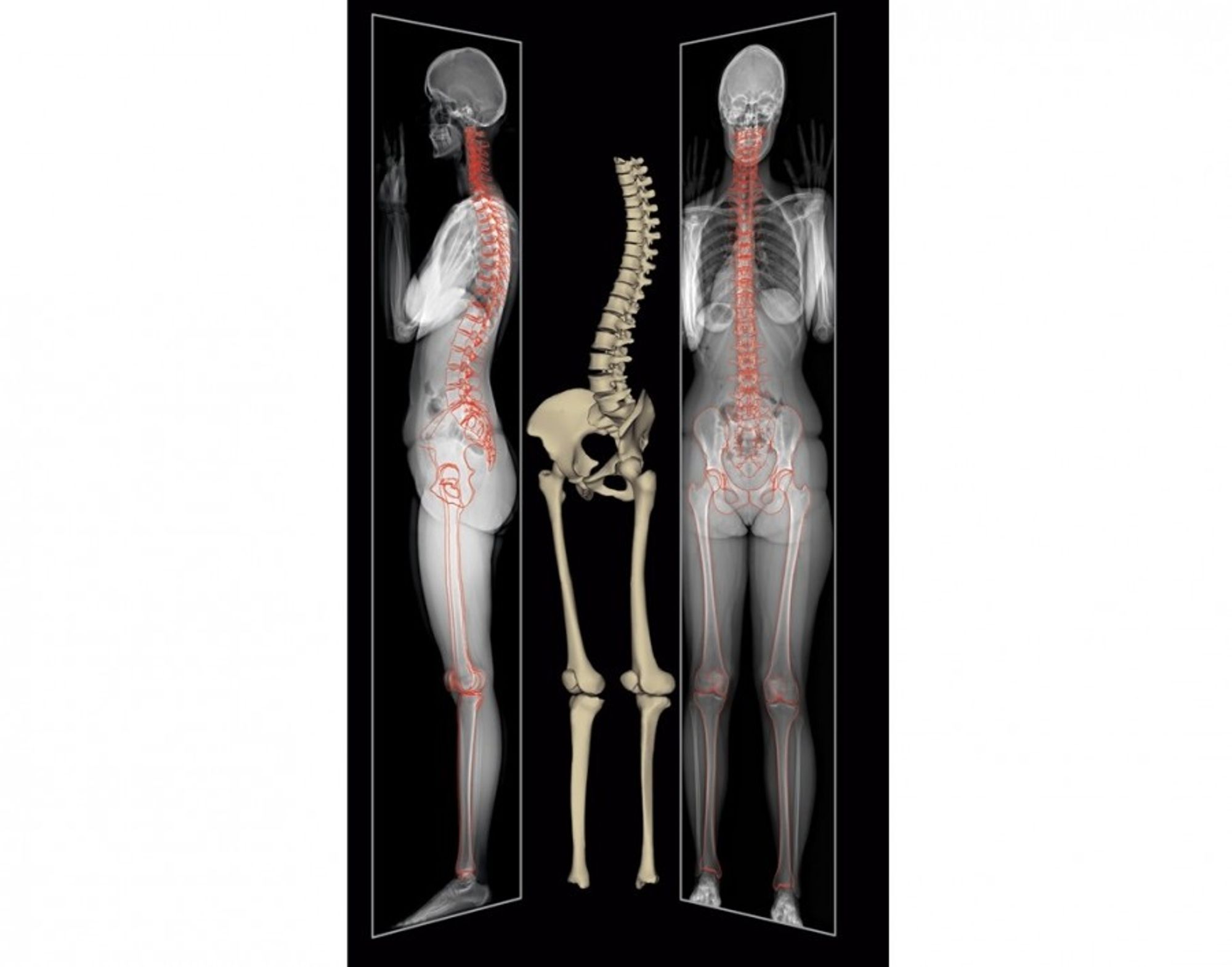 INNOVATION SANTE - Grâce à vous, la Fondation Hôpital Saint Joseph fait l'acquisition d'un nouveau système d'imagerie médicale