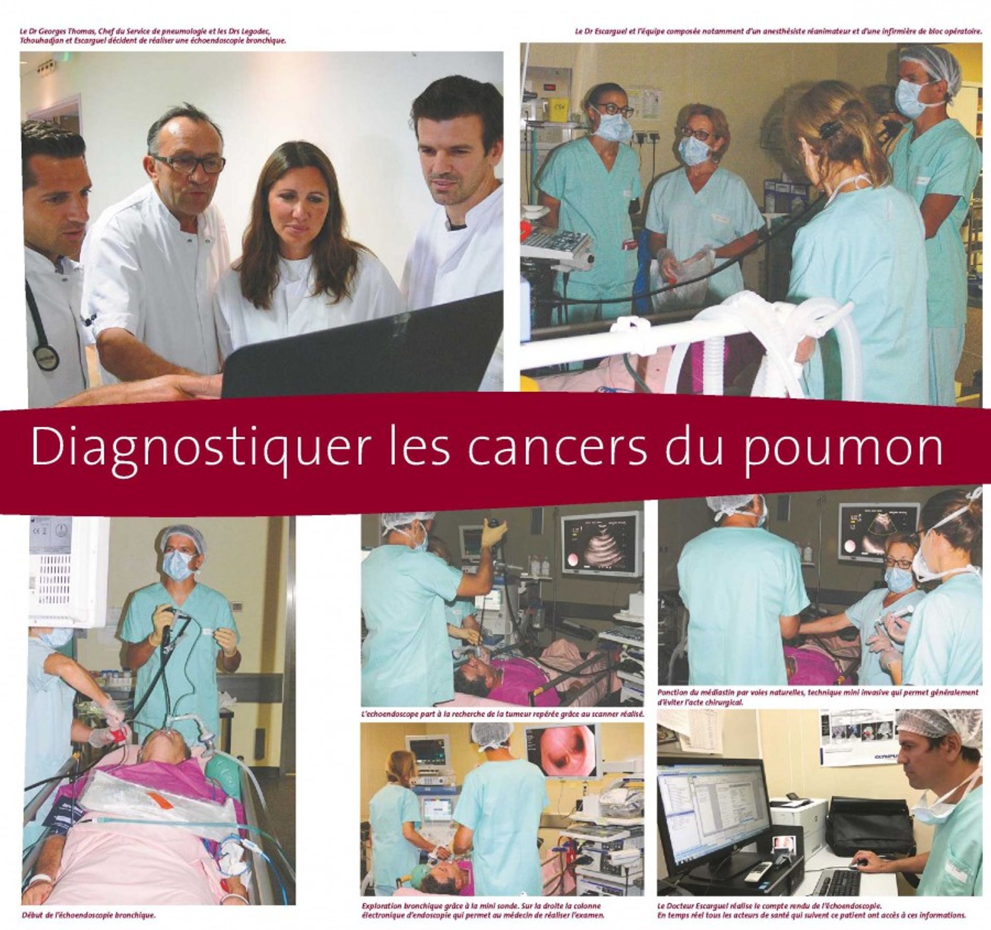 Nouvelle Lettre aux amis sur le diagnostic des cancers du poumon