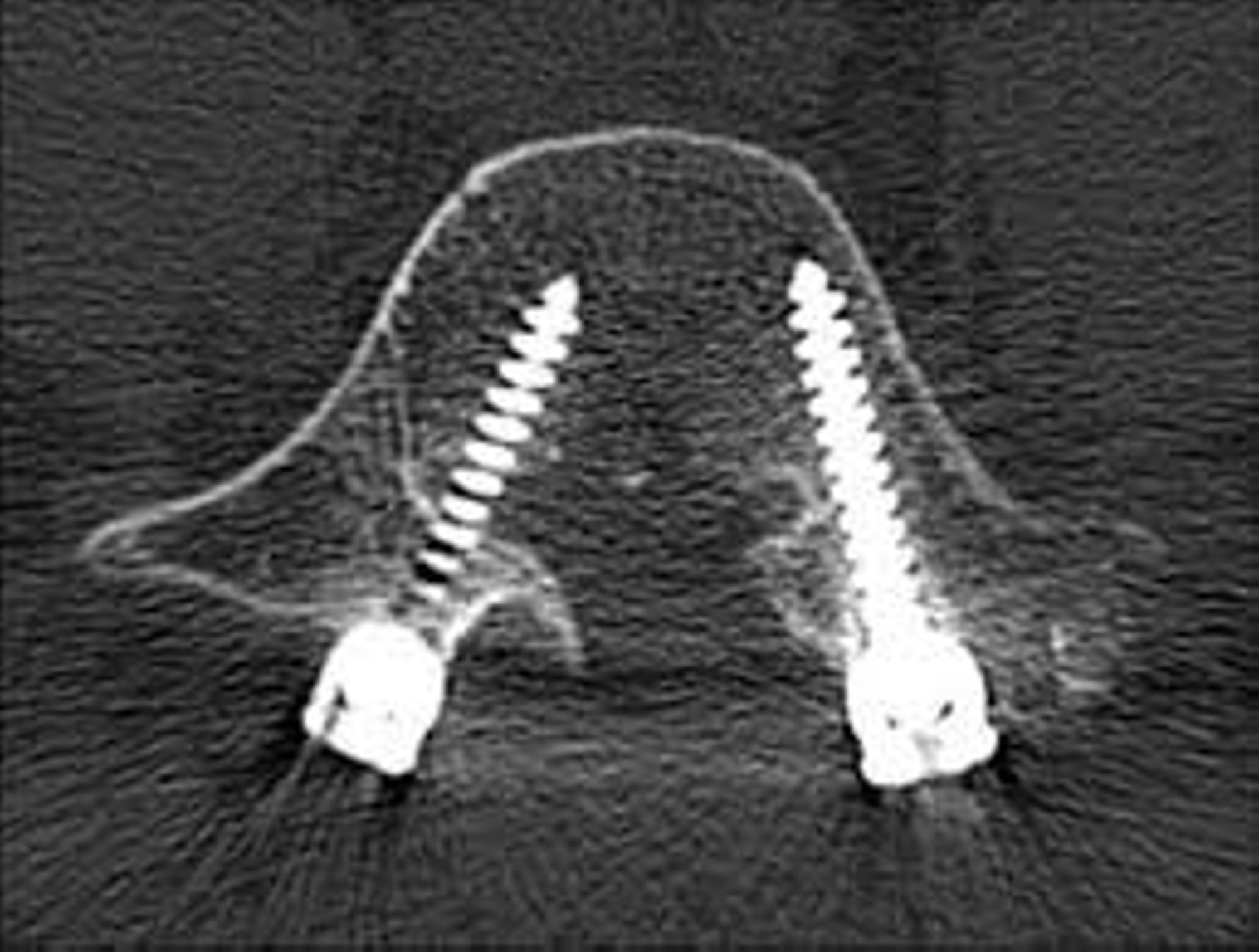 L’équipement PYTHEAS NAVIGATION